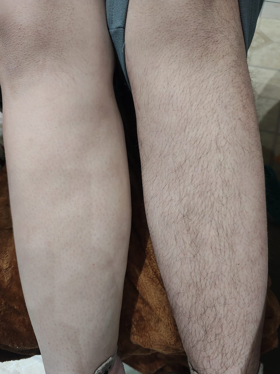 Vellux Shaver ® - Depiladora de Cristal