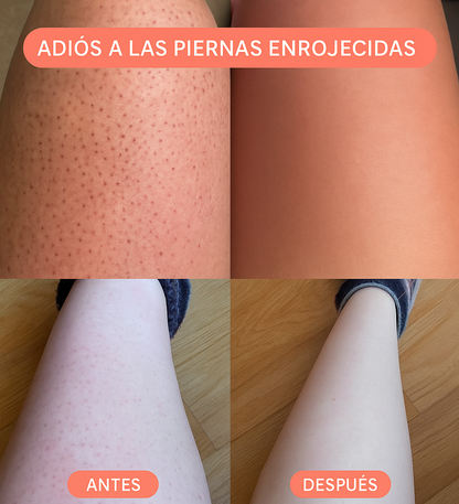 Vellux Shaver ® - Depiladora de Cristal