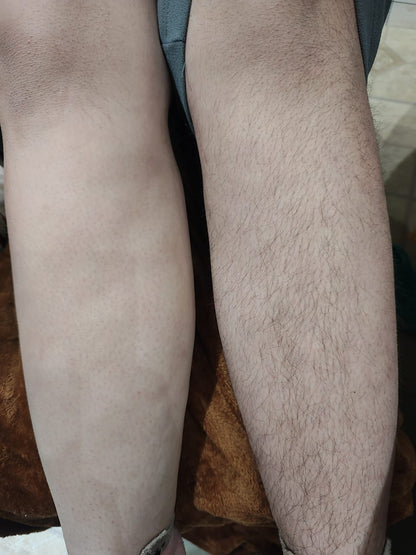 Vellux Shaver ® - Depiladora de Cristal